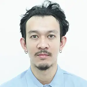 ก่อนปลูกหนวด เกศา คลินิก | Beard Transplant Before - Kesa Hair Clinic
