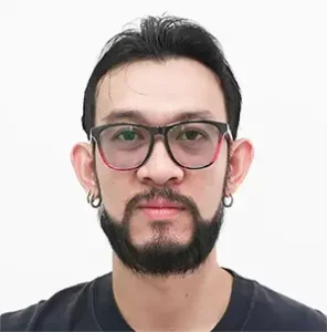 หลังปลูกหนวด เกศา คลินิก | Beard Transplant After - Kesa Hair Clinic