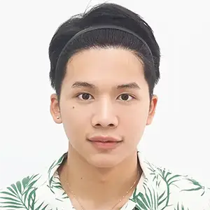 หลังปลูกผมผู้ชาย เกศา คลินิก | Male Hair Transplant After - Kesa Hair Clinic