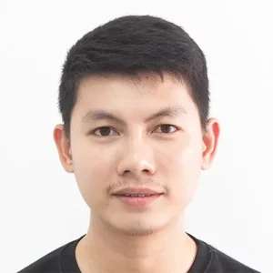 ก่อนปลูกคิ้ว เกศา คลินิก | Eyebrow Transplant Before - Kesa Hair Clinic