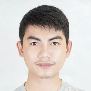 หลังปลูกคิ้ว เกศา คลินิก | Eyebrow Transplant After - Kesa Hair Clinic