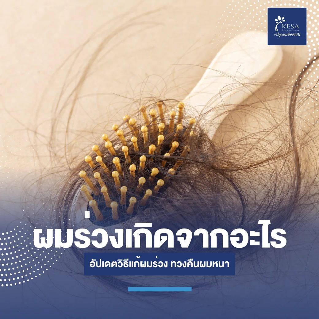 ผมร่วงเกิดจากอะไร